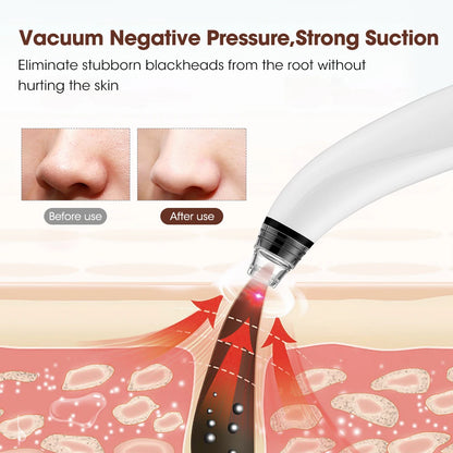 Camera Visual Blackhead Remover