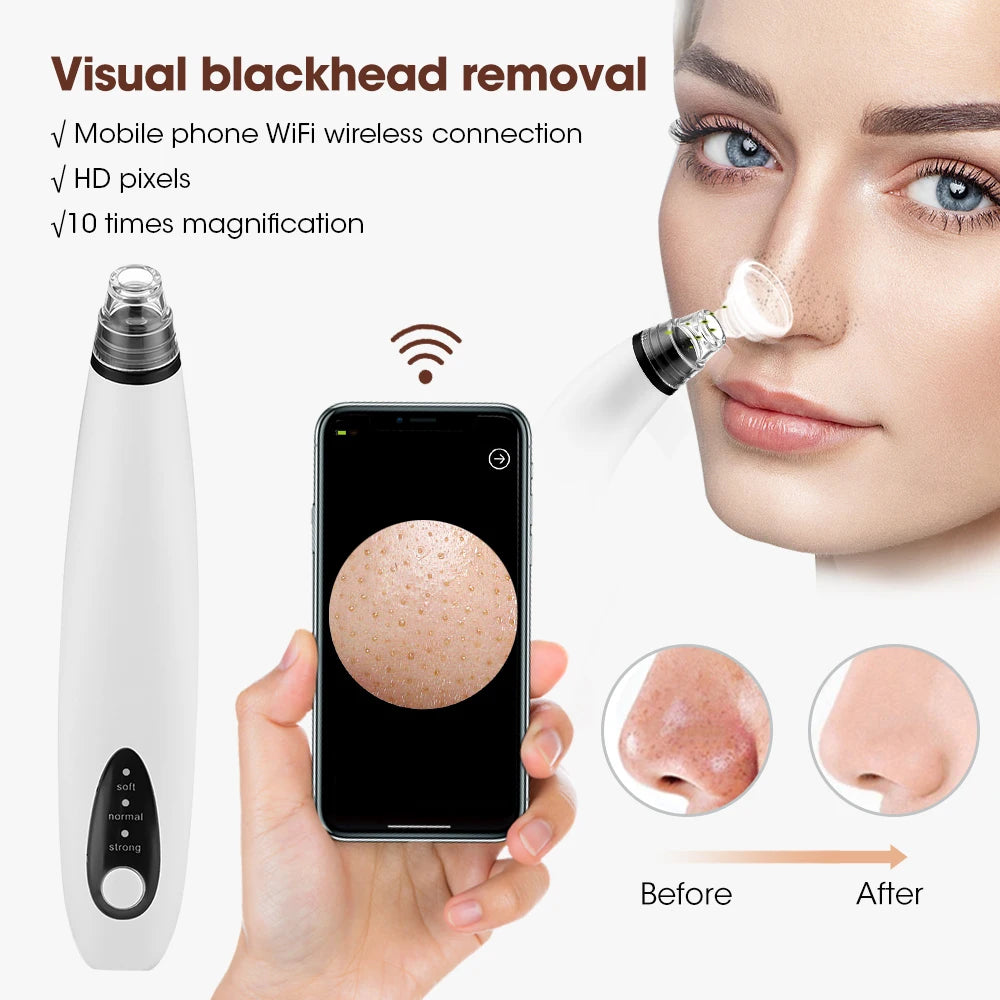 Camera Visual Blackhead Remover