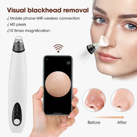 Camera Visual Blackhead Remover